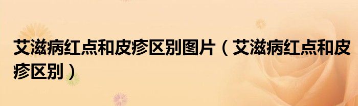 艾滋病红点和皮疹区别图片（艾滋病红点和皮疹区别）